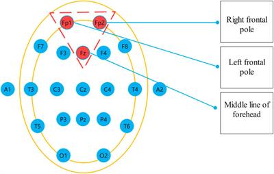 EEG diagnosis of depression based on multi-channel data fusion and clipping augmentation and convolutional neural network